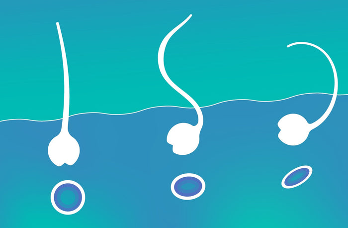 Science Class 08: how curls happen